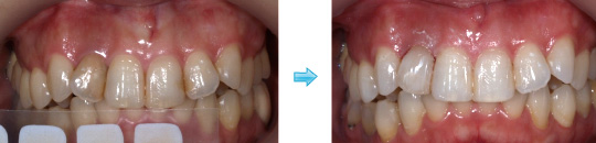 �z�[���z���C�g�j���O