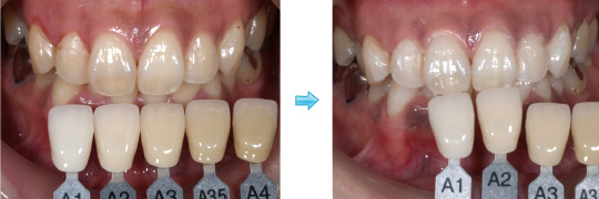 オフィスホワイト二ング