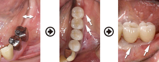 �C���v�����g����(�f�a�q�j�ߒ�