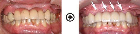 �C���v�����g����(�f�a�q�j�ߒ�