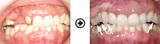 �C���v�����g����(�f�a�q�j�ߒ�