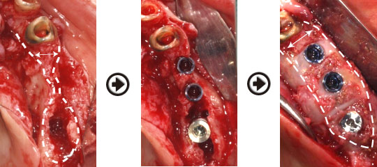 �C���v�����g����(�f�a�q�j�ߒ�