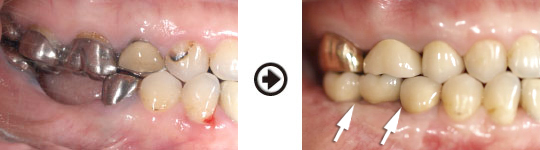 �C���v�����g����(�f�a�q�j�ߒ�