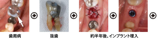 �����a�@�����@�񔼔N��A�C���v�����g����