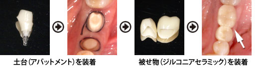 �����a�@�����@�񔼔N��A�C���v�����g����
