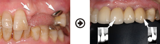 �C���v�����g����(�f�a�q�j�ߒ�