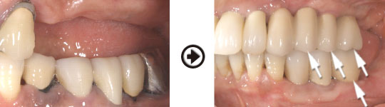 �C���v�����g����(�f�a�q�j�ߒ�