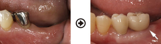 �C���v�����g����(�f�a�q�j�ߒ�