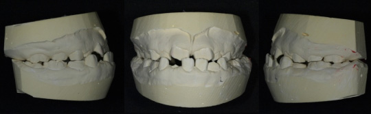 �p���i���������j