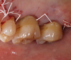 �Đ����ÍH��