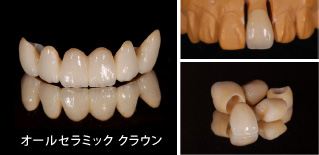 �I�[���Z���~�b�N�N���E��