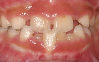 �����O�̎�����