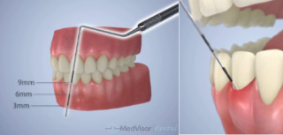 �|�P�b�g�̌v��