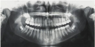 �G�b�N�X���ʐ^����